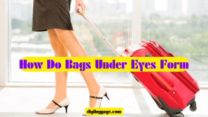 How-Do-Bags-Under-Eyes-Form